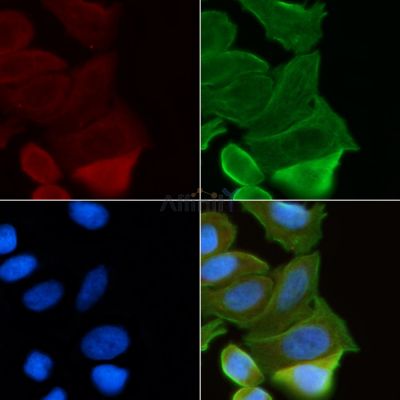 OTUB2 Antibody - AF9147 staining Hela cells(30min of UV treatment) by IF/ICC.