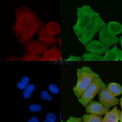 PDE4B/C/D Antibody - AF9151 staining Hela cells(30min of UV treatment) by IF/ICC.