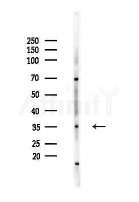 PIG3 Antibody - Western blot analysis of lysates from HUVEC cells(heat-shock,45min treatment), using PIG3 Antibody at 1/1000 dilution.