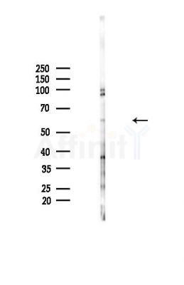 POTE14/22 Antibody - Western blot analysis of lysates from Mouse brain, using POTE14/22 Antibody at 1/1000 dilution.
