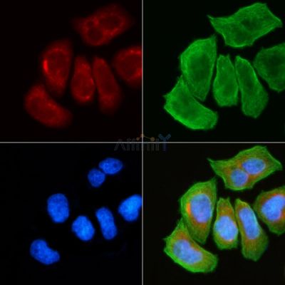 POTE-14/22 Antibody - AF9168 staining Hela cells(30min of UV treatment) by IF/ICC.