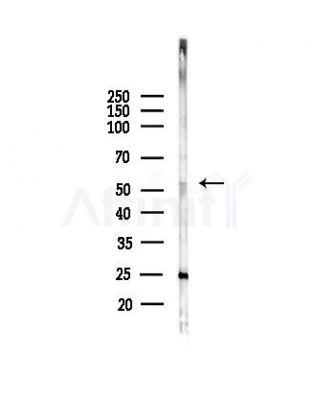 PRPF31 Antibody - Western blot analysis of lysates from COLO205 cells(heat-shock, 45min treatment), using PRPF31 Antibody at 1/1000 dilution.
