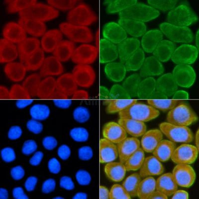 PTP IA-2beta Antibody - AF9171 staining Hela cells(30min of UV treatment) by IF/ICC.