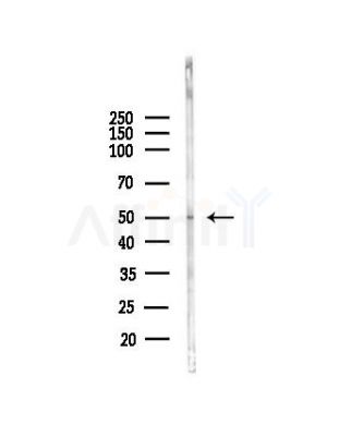 RBM34 Antibody - Western blot analysis of lysates from COLO205 cells(heat-shock, 45min treatment), using RBM34 Antibody at 1/1000 dilution.