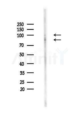 SAF-A2 Antibody - Western blot analysis of lysates from HUVEC cells(heat-shock,45min treatment), using SAF-A2 Antibody at 1/1000 dilution.