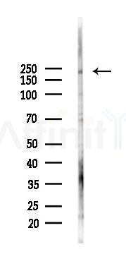 Separase Antibody - Western blot analysis of lysates from K562 cells(UV,30min treatment), using Separase Antibody at 1/1000 dilution.