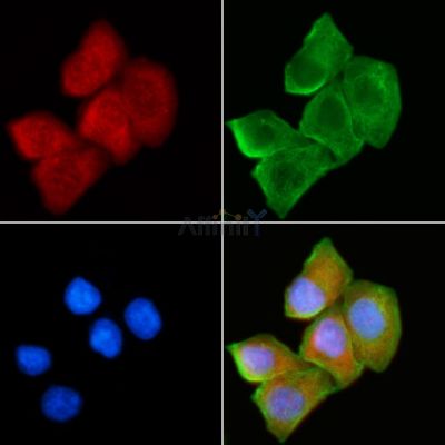 SH3BGR Antibody - AF9198 staining Hela cells(30min of UV treatment) by IF/ICC.