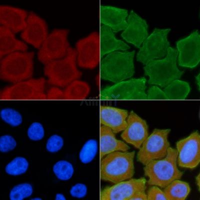 STAM2 Antibody - AF9203 staining Hela cells(30min of UV treatment) by IF/ICC.