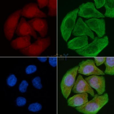 TAB182 Antibody - AF9207 staining Hela cells(30min of UV treatment) by IF/ICC.