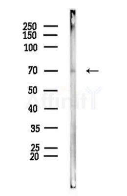 TBX2 Antibody - Western blot analysis of lysates from PC12 cells, using TBX2 Antibody at 1/1000 dilution.