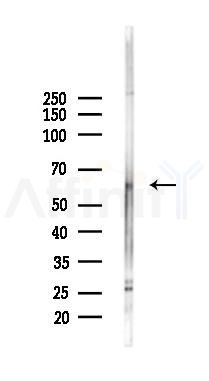 TCFL5 Antibody - Western blot analysis of lysates from K562 cells(UV,30min treatment), using TCFL5 Antibody at 1/1000 dilution.