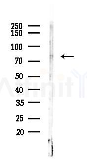 TMC8 Antibody - Western blot analysis of lysates from A2780 cells(starvation,24h treatment), using TMC8 Antibody at 1/1000 dilution.