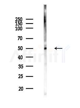 THR alpha Antibody - Western blot analysis of lysates from MCF7 cells(heat-shock,45min treatment), using THR alpha Antibody at 1/1000 dilution.