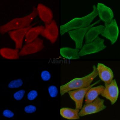 UBE3B Antibody - AF9221 staining Hela cells(30min of UV treatment) by IF/ICC.