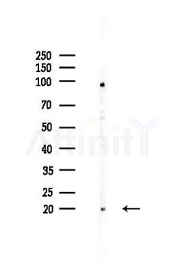 UMP/CMP kinase Antibody - Western blot analysis of lysates from HUVEC cells(heat-shock,45min treatment), using UMP/CMP kinase Antibody at 1/1000 dilution.