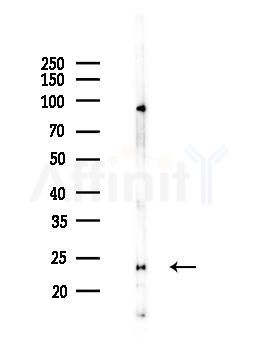 UMP/CMP kinase Antibody - Western blot analysis of lysates from Mouse brain, using UMP/CMP kinase Antibody at 1/1000 dilution.