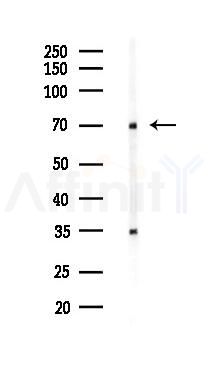 WAVE1 Antibody - Western blot analysis of lysates from 293 cells(UV,30min treatment), using WAVE1 Antibody at 1/1000 dilution.