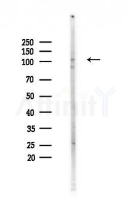 WBSCR11 Antibody - Western blot analysis of lysates from HUVEC cells(heat-shock,45min treatment), using WBSCR11 Antibody at 1/1000 dilution.