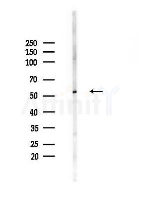 ATP6V1B2 Antibody - Western blot analysis of lysates from HUVEC cells(heat-shock,45min treatment), using ATP6V1B2 Antibody at 1/1000 dilution.