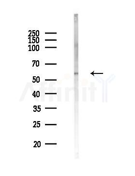 ATP6V1B2 Antibody - Western blot analysis of lysates from MCF7 cells(heat-shock,45min treatment), using ATP6V1B2 Antibody at 1/1000 dilution.