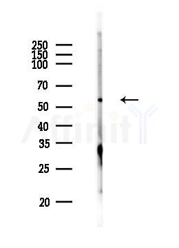 ATP6V1B2 Antibody - Western blot analysis of lysates from PC12 cells, using ATP6V1B2 Antibody at 1/1000 dilution.