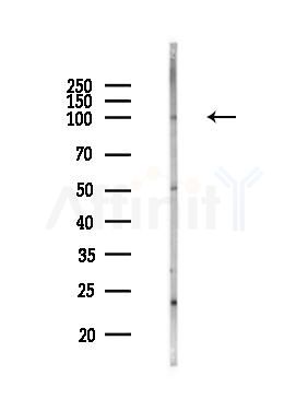 ATP6V0A2 Antibody - Western blot analysis of lysates from MCF7 cells(heat-shock,45min treatment), using ATP6V0A2 Antibody at 1/1000 dilution.