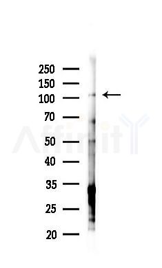 ZNF295 Antibody - Western blot analysis of lysates from Hela cells(starvation,24h treatment), using ZNF295 Antibody at 1/1000 dilution.