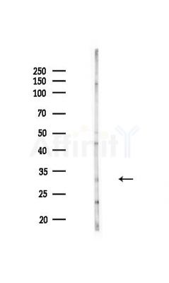 SLC30A2 Antibody - Western blot analysis of lysates from MDA-MB-231 cells(heat-shock,45min treatment), using SLC30A2 Antibody at 1/1000 dilution.