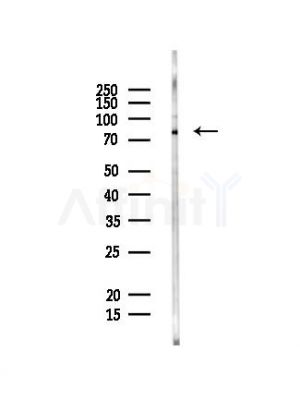 ZP2 Antibody - Western blot analysis of lysates from PC12 cells, using ZP2 Antibody at 1/1000 dilution.