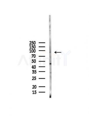 AKAP4 Antibody - Western blot analysis of lysates from Mouse brain, using AKAP4 Antibody at 1/1000 dilution.
