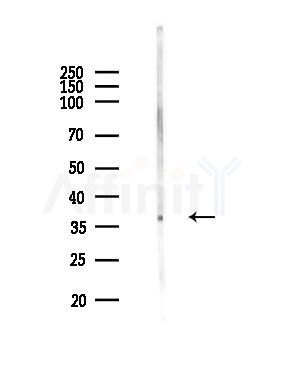 GFI1B Antibody - Western blot analysis of lysates from MCF7 cells(heat-shock,45min treatment), using GFI1B Antibody at 1/1000 dilution.