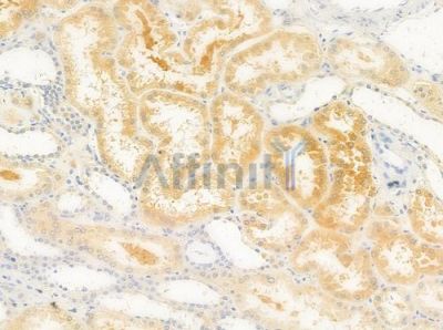 CYFIP1 Antibody - DF10059 at 1/100 staining human normal kidney tissue by IHC-P.