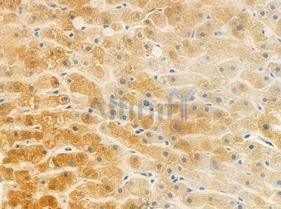 TRMT11 Antibody - DF10060 at 1/100 staining human normal liver tissue by IHC-P.