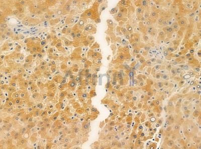 TRMT11 Antibody - DF10060 at 1/100 staining human normal liver tissue by IHC-P.