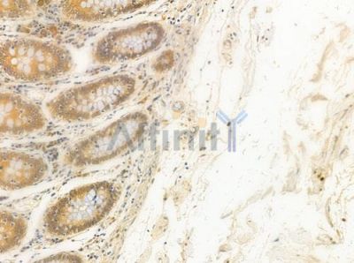 DMRTC2 Antibody - DF10062 at 1/100 staining human normal colon tissue by IHC-P.