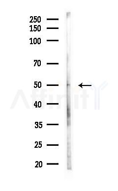 MINA Antibody - Western blot analysis of lysates from HUVEC cells(LPS, 4h treatment), using MINA Antibody at 1/1000 dilution.