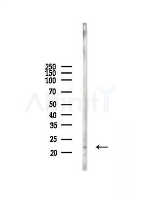 DUX5 Antibody - Western blot analysis of lysates from Mouse liver, using DUX5 Antibody at 1/1000 dilution.
