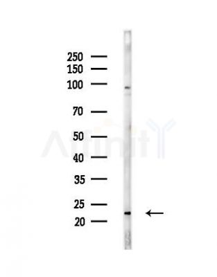 DUX5 Antibody - Western blot analysis of lysates from HepG2 cells(heat-shock,45min treatment), using DUX5 Antibody at 1/1000 dilution.