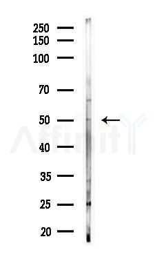 RHCG Antibody - Western blot analysis of lysates from HUVEC cells(LPS, 4h treatment), using RHCG Antibody at 1/1000 dilution.