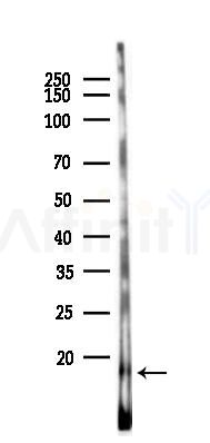 COX7A2L Antibody - Western blot analysis of lysates from 293 cells(UV,30min treatment), using COX7A2L Antibody at 1/1000 dilution.