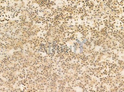 DEDD Antibody - DF10100 at 1/100 staining human pituitary adenoma by IHC-P.