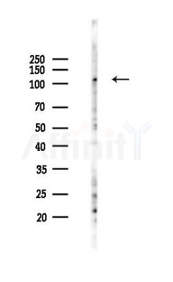 GRIK5 Antibody - Western blot analysis of lysates from K562 cells(UV,30min treatment), using GRIK5 Antibody at 1/1000 dilution.