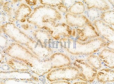 IL22RA2 Antibody - DF10107 at 1/100 staining human normal kidney tissue by IHC-P.