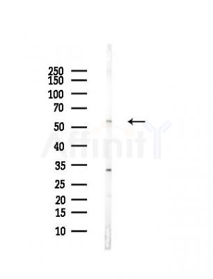 IL28RA Antibody - Western blot analysis of lysates from Mouse liver, using IL28RA Antibody at 1/1000 dilution.