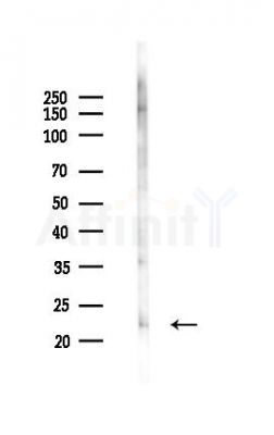 IFNW1 Antibody - Western blot analysis of lysates from K562 cells(UV,30min treatment), using IFNW1 Antibody at 1/1000 dilution.