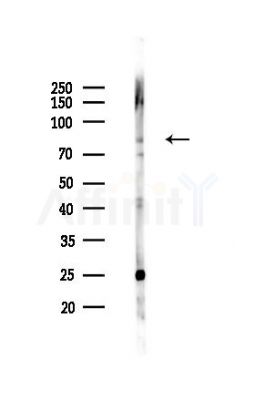 IL31R Antibody - Western blot analysis of lysates from K562 cells(UV,30min treatment), using IL31R Antibody at 1/1000 dilution.