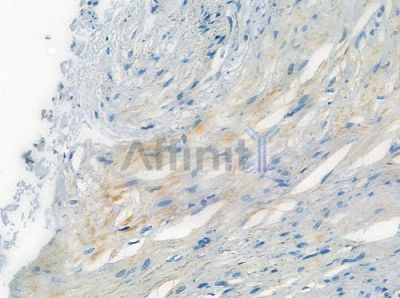 Cytochrome P450 2A6/7/13 Antibody - DF10129 at 1/100 staining human normal colon tissue by IHC-P.