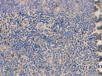 CEACAM8 Antibody - DF10151 at 1/100 staining human normal tonsil tissue by IHC-P.