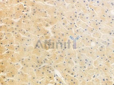 ADAM8 Antibody - DF10153 at 1/100 staining human normal liver tissue by IHC-P.