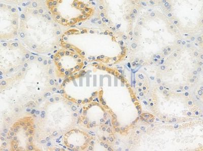 IL27RA Antibody - DF10160 at 1/100 staining human normal kidney tissue by IHC-P.